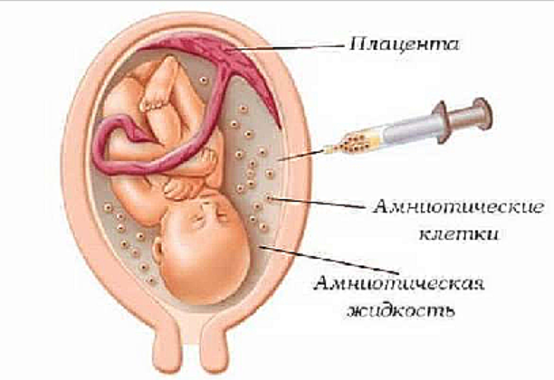 амниотическая жидкость 2.png